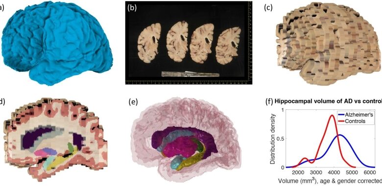 New computer system tools can rebuild 3D brain from biobank images