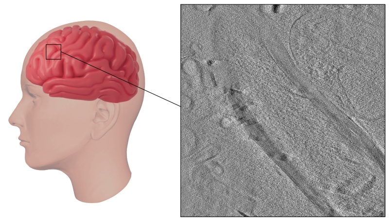 Utilizing ion beams to enhance brain microscopy