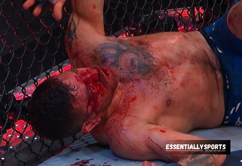 “If He Dies He Dies”– Conor McGregor, Dustin Poirier & Pros Pay Respect to Jim Miller After Being Cut Open by Bobby Green at UFC 300