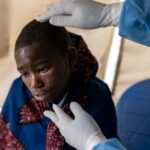 How fatal is mpox and what treatments are readily available?