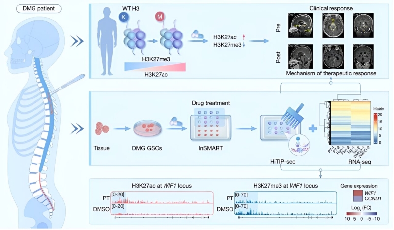 A microarray-based high-throughput in situ tagged immunoprecipitation sequencing innovation for diffuse midline glioma