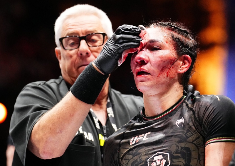 UFC medical professional shares scary photos of the ‘worst cut in history’ suffered by Irene Aldana at Noche UFC last night