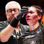 UFC medical professional shares scary photos of the ‘worst cut in history’ suffered by Irene Aldana at Noche UFC last night