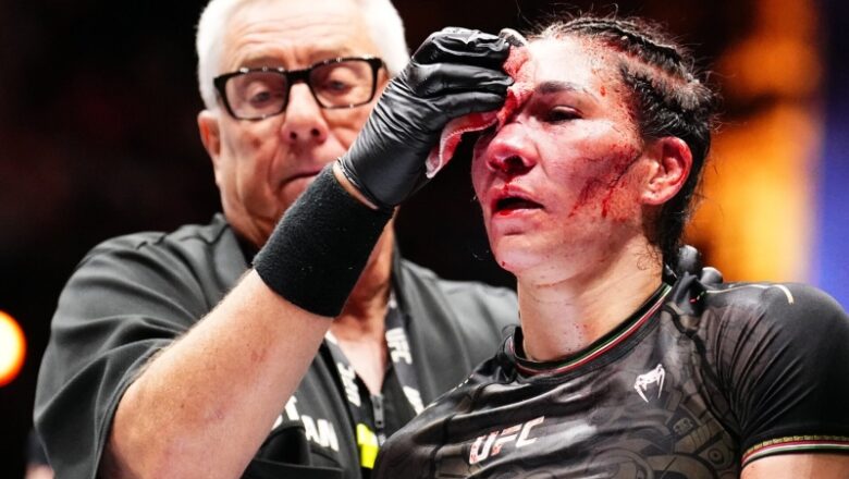 UFC medical professional shares scary photos of the ‘worst cut in history’ suffered by Irene Aldana at Noche UFC last night