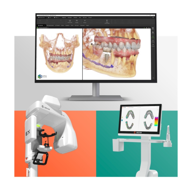 DEXIS Digital Ecosystem Expands With Three New Innovations To Streamline and Connect Dental Workflows