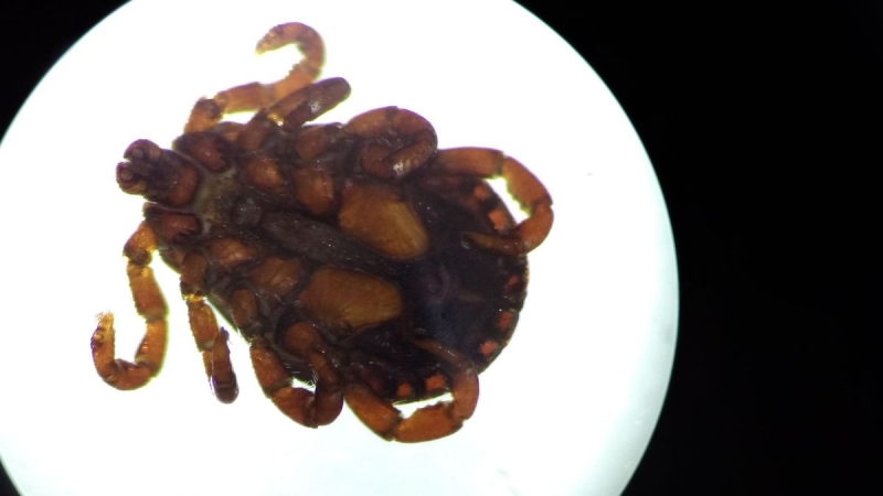 New tick-borne infection found in China can impact the brain, researchers report