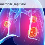 FDA Expands Approval of Osimertinib in Lung Cancer