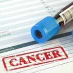 Cancer Diagnoses Slow to Recover From Effects of COVID Pandemic