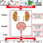 Microplastics discovered in urinary system connected to health threats