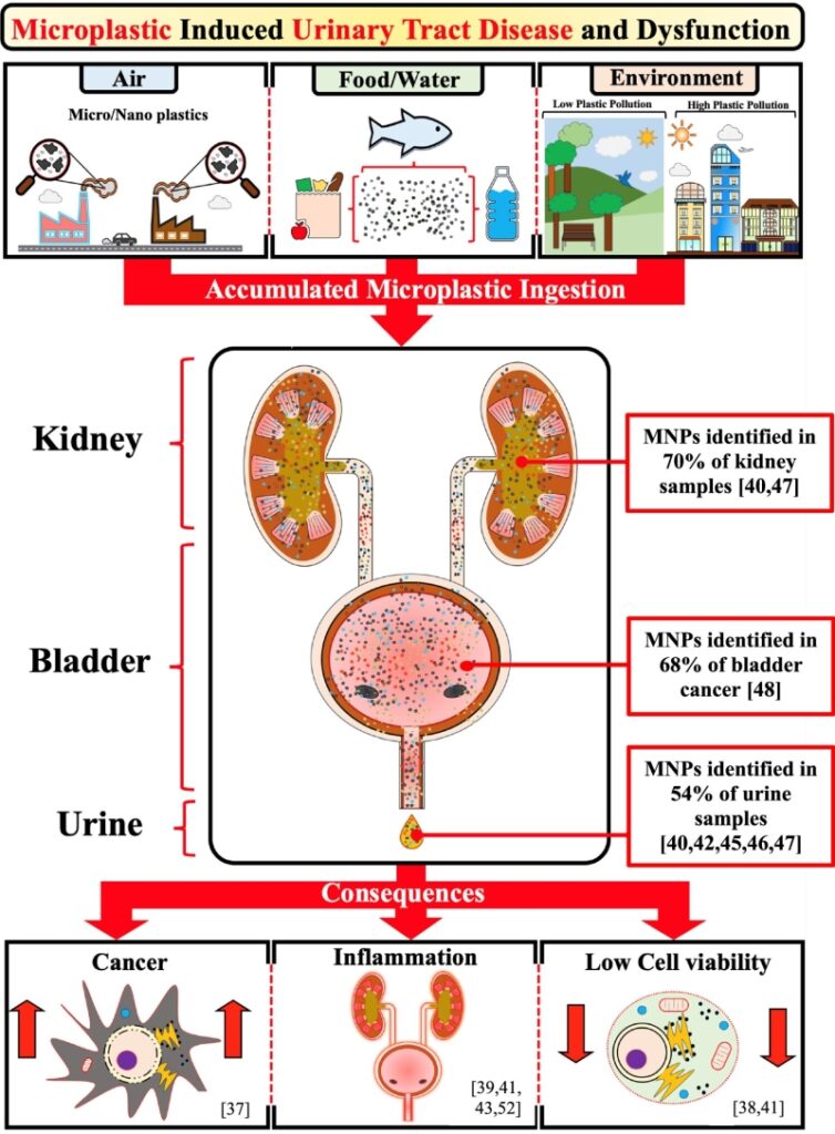 Microplastics discovered in urinary system connected to health threats