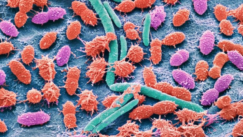 Researchers develop tool to see how ‘healthy’ your gut microbiome is– does it work?