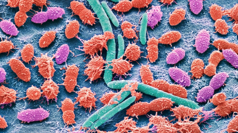 Researchers develop tool to see how ‘healthy’ your gut microbiome is– does it work?