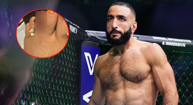 Doctor information Belal Muhammad’s bone infection that required UFC 310 withdrawal