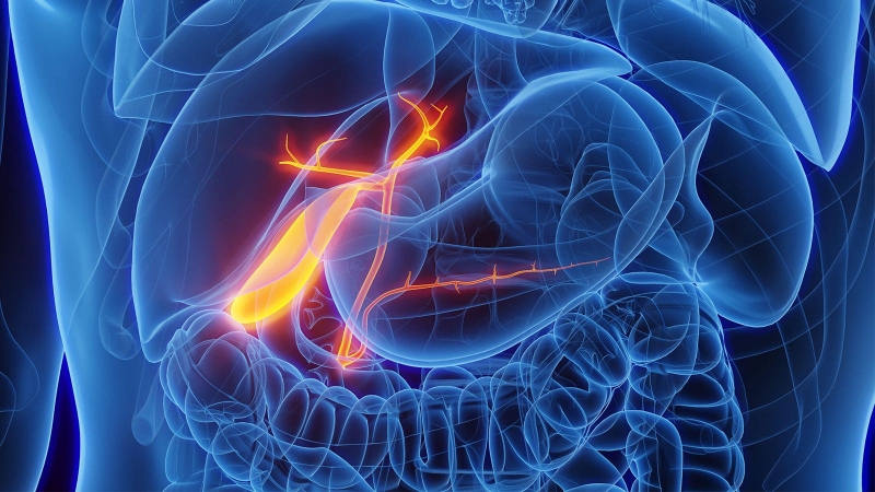 Handling Primary Biliary Cholangitis Progression and Symptoms