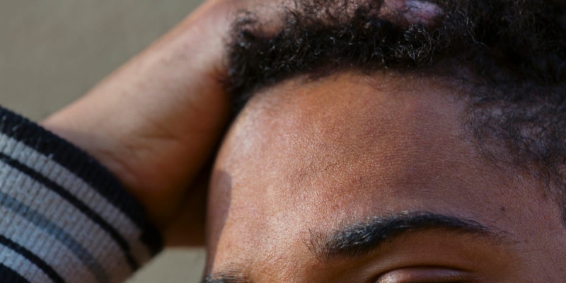 Is This Stem-Cell Hair Regrowth Treatment Worth It? Here’s What One Man Learned