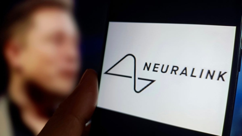 Elon Musk’s Neuralink gets approval to check whether its brain chip can manage a robotic arm