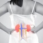 Upgraded Lupus Nephritis Guideline Advises Triple Therapy