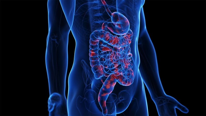 JAK Inhibitor Comes Up Short in Phase III Crohn’s Disease Trial