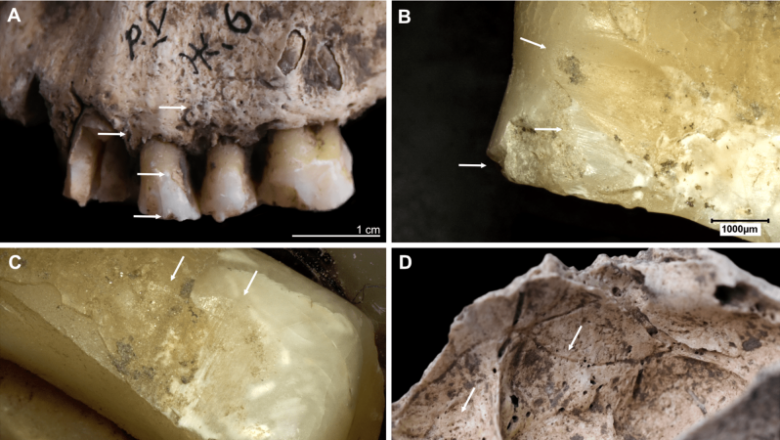 Fire most likely eliminated a group of Stone Age human beings discovered in Ukraine