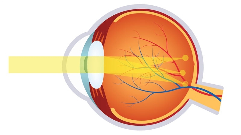 Eye Toxicities Are a Growing Concern With Certain ADCs