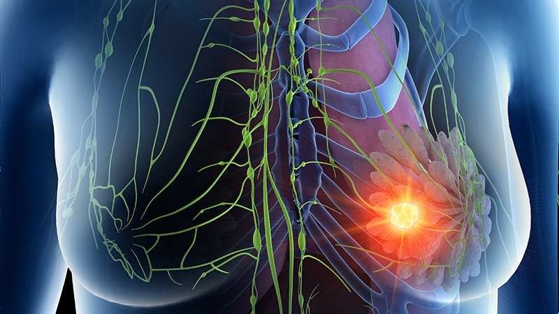 When to Use Anthracyclines in Early Breast Cancer