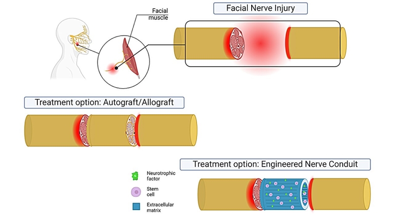 Engineering a smile: Stem cell– based avenues bring back facial nerve function in animal research study