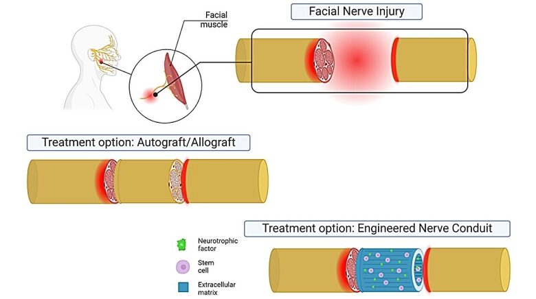 Engineering a smile: Stem cell– based avenues bring back facial nerve function in animal research study