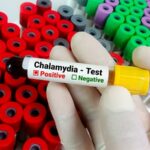 Doxycycline Kits Boost Chlamydia Treatment in ED