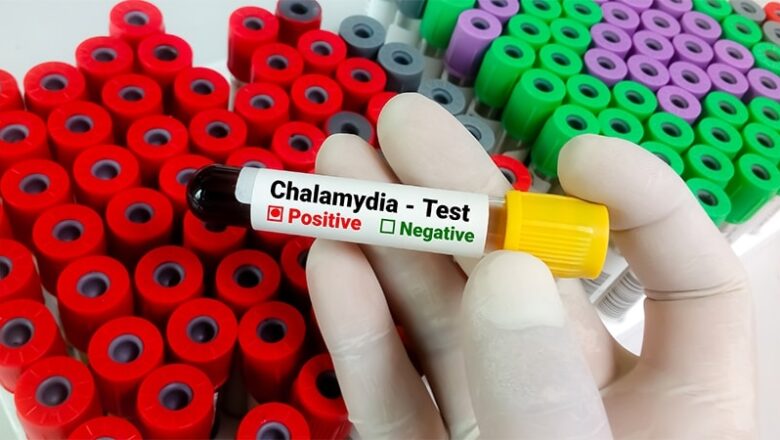 Doxycycline Kits Boost Chlamydia Treatment in ED