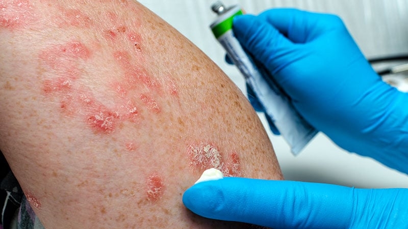 Integrated Psoriasis/PsA Clinics: Potential and Pitfalls