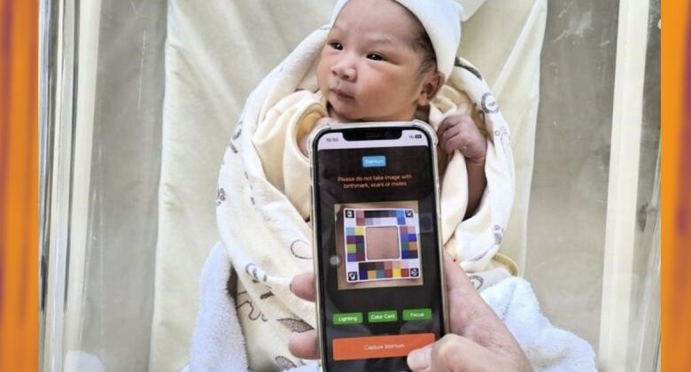 This AI app lets moms and dads search for indications of baby jaundice in your home