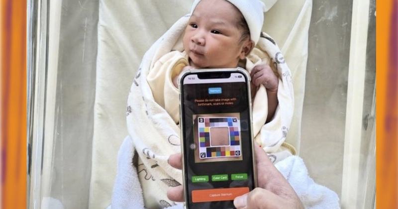 This AI app lets moms and dads search for indications of baby jaundice in your home